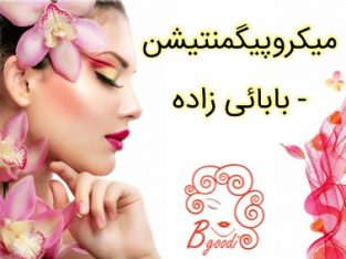 میکروپیگمنتیشن – بابائی زاده