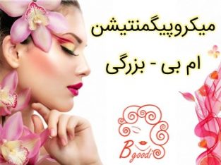 میکروپیگمنتیشن ام بی – بزرگی