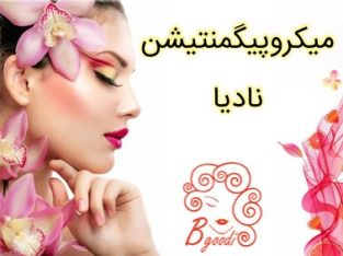 میکروپیگمنتیشن نادیا