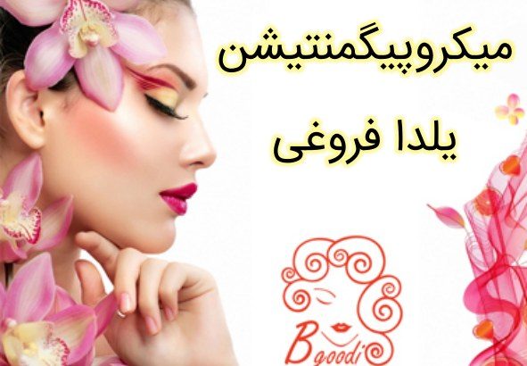 میکروپیگمنتیشن یلدا فروغی